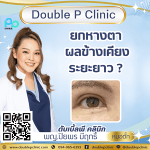 ยกหางตา ผลข้างเคียงระยะยาว ?