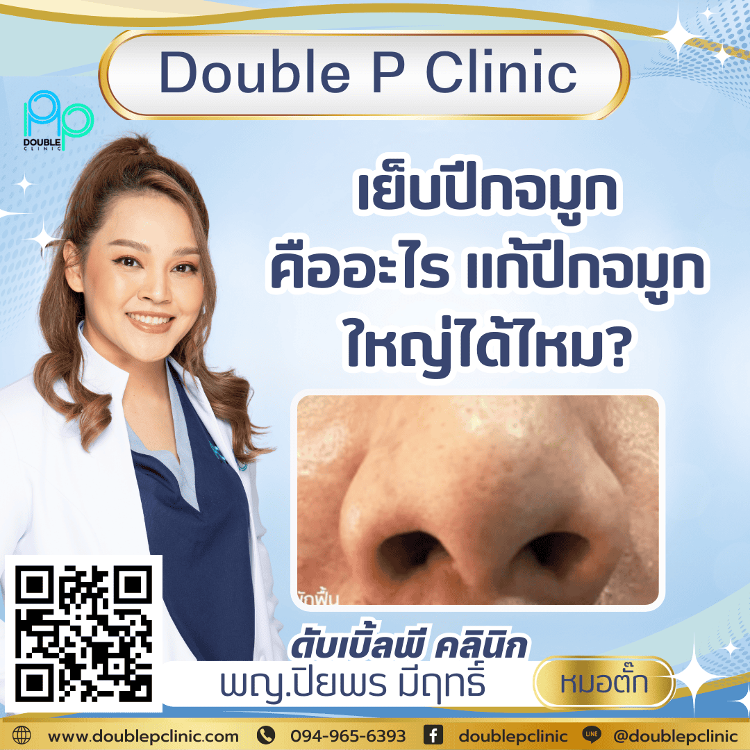  เย็บปีกจมูก คืออะไร แก้ปีกจมูกใหญ่ได้ไหม?