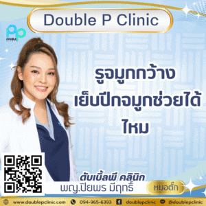 รูจมูกกว้าง เย็บปีกจมูกช่วยได้ไหม 