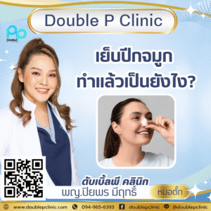 เย็บปีกจมูก ทำแล้วเป็นยังไง?