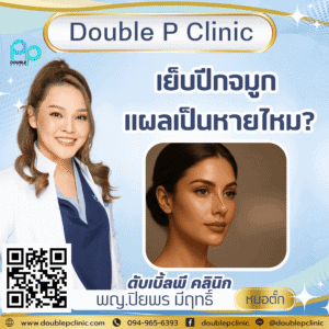 เย็บปีกจมูก แผลเป็นหายไหม?