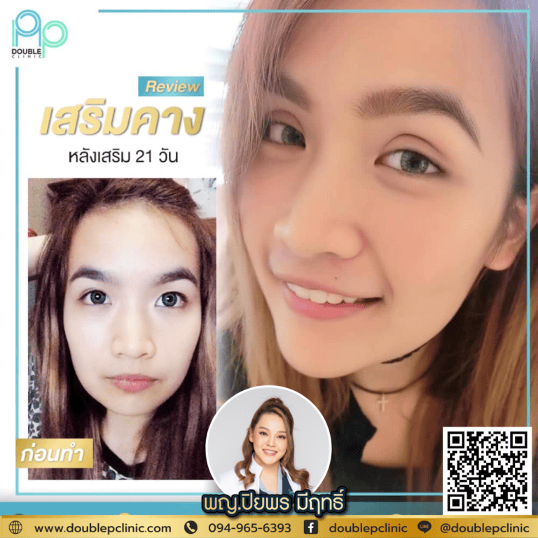 เสริมคางแผลใน vs ฉีดฟิลเลอร์คาง อันไหนดีกว่า?