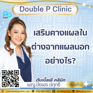 เสริมคางแผลใน ต่างจากแผลนอกอย่างไร?