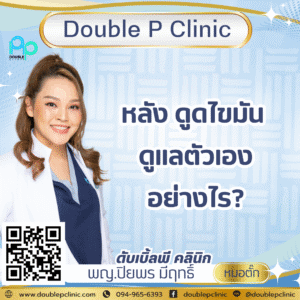 หลัง ดูดไขมัน ดูแลตัวเองอย่างไร